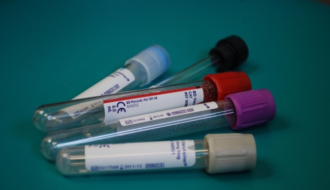 Брендированные автомобили «Тест на ВИЧ: Экспедиция» приближаются к границе Марий Эл