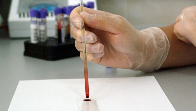 Республиканская станция переливания крови будет проводить обследование на антитела к коронавирусу Sars-CoV-2
