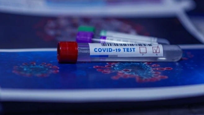В стационарах Марий Эл находится свыше 260 пациентов с подтверждённым коронавирусом