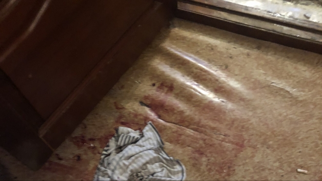 В одном из общежитий Йошкар-Олы забили насмерть 40-летнюю женщину 18+