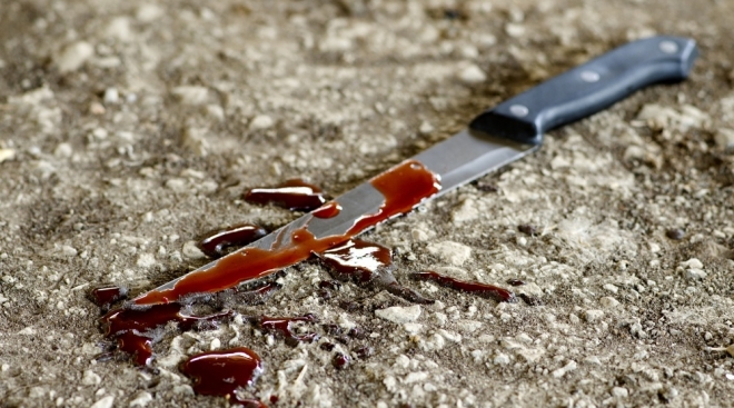 В Йошкар-Оле женщина из-за ключей ранила сожителя ножом