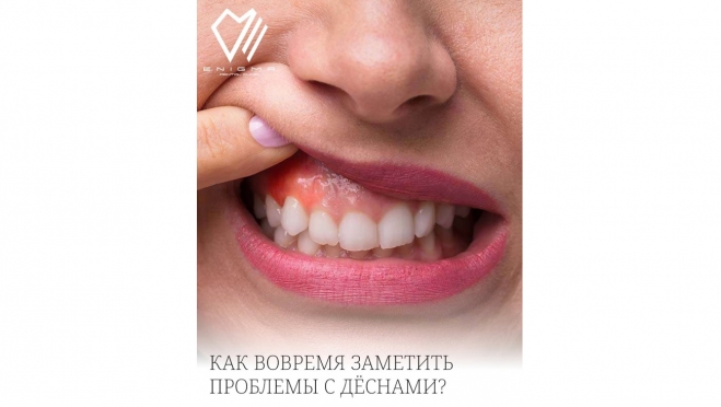 Как вовремя заметить проблемы с дёснами?