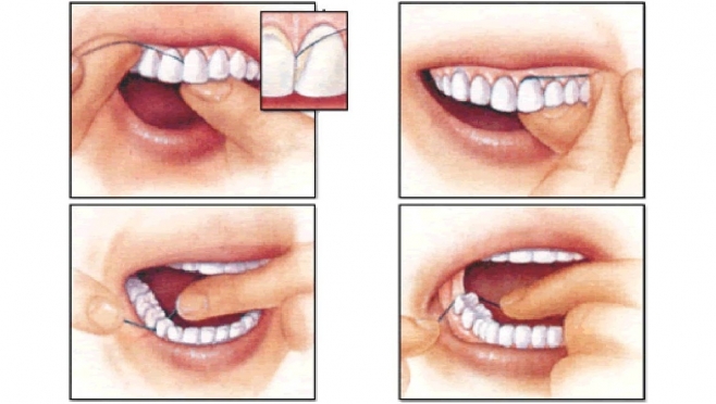 Как правильно пользоваться зубной нитью?