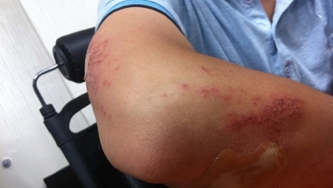 Сотрудники ЧОПа подозреваются в разбойном нападении на йошкаролинца