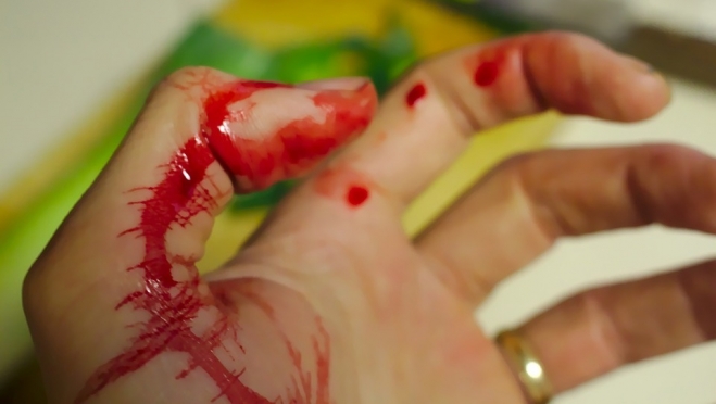 Следователи Марий Эл проводят проверку по травме на производстве