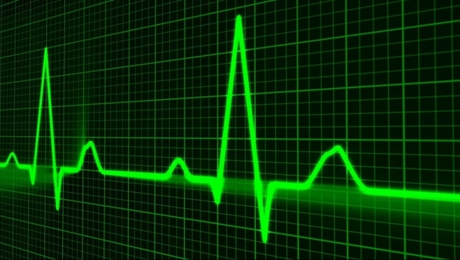 Новое оборудование получат сосудистые центры Йошкар-Олы, Волжска и Сернура