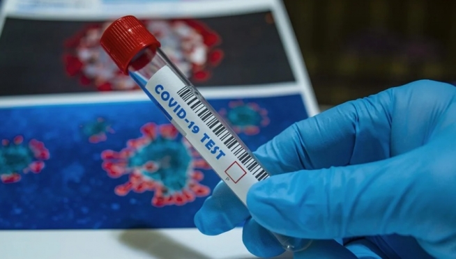 В Марий Эл проведено более 50 тысяч тестов на коронавирус