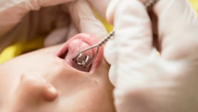 Логопедически массаж