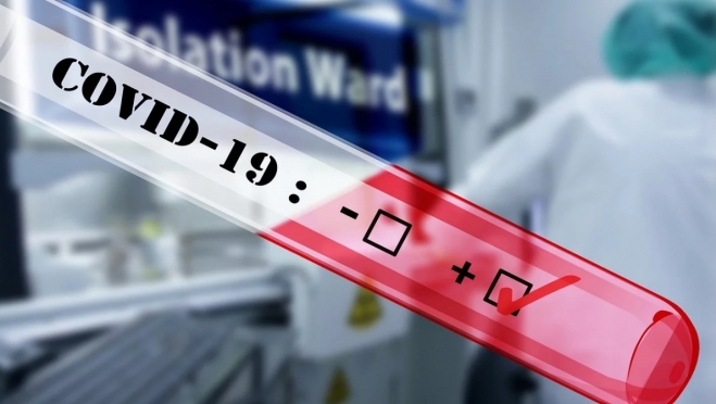 В Марий Эл два человека скончались от коронавируса за сутки