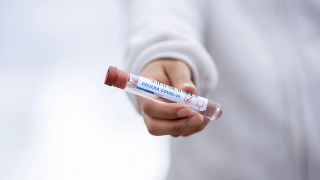 Центр-СПИД в Йошкар-Оле запустил тестирование на коронавирус