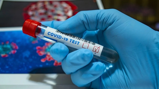 В Марий Эл провели почти 30 тысяч исследований на COVID-19