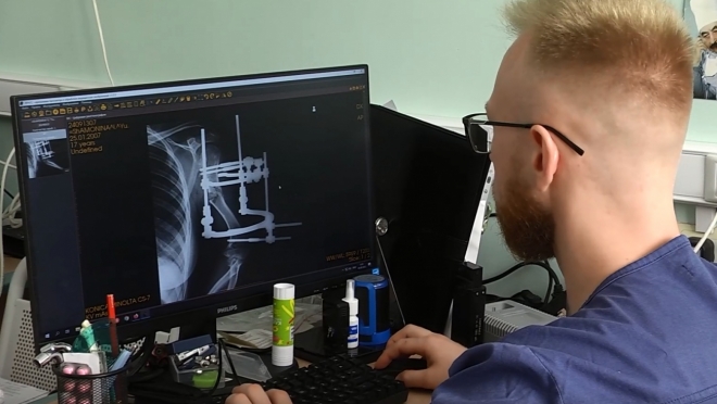 Уникальная операция: девушке с редкой патологией врачи в ПФО удлинили руку