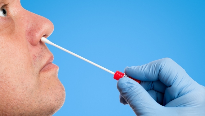 В Марий Эл за сутки зарегистрировано 30 новых случаев  COVID 19