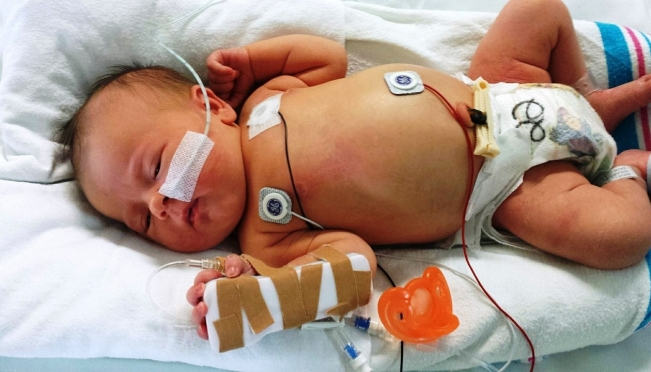 В Перинатальном центре отметят Международный день недоношенных детей