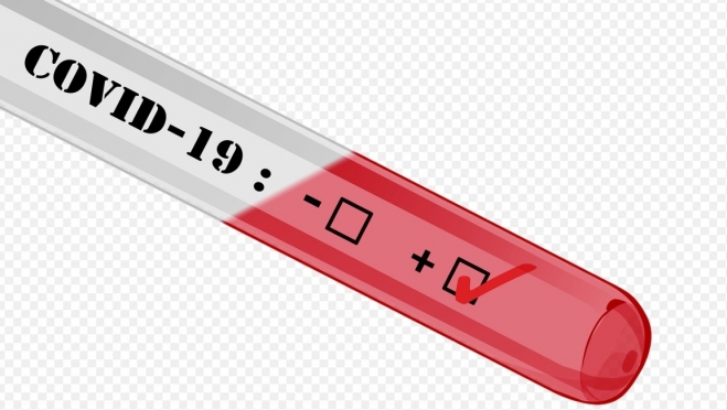 Коронавирус: 71 заболевший за сутки