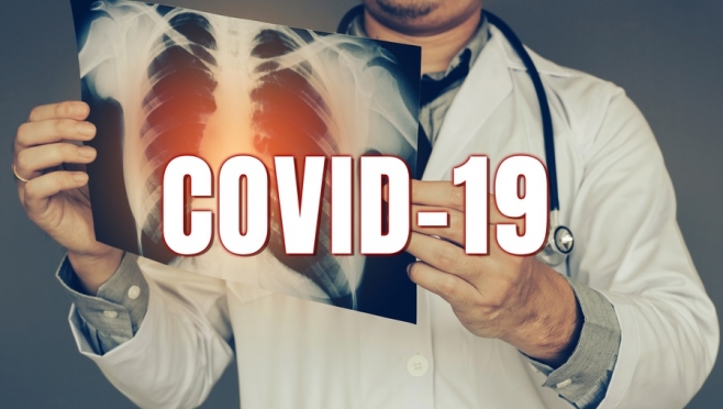 В Марий Эл зарегистрировано 180 случаев COVID-19