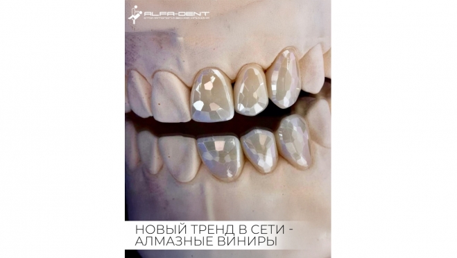 Новый тренд в стоматологии — алмазные виниры