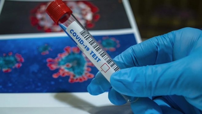 За сутки в Марий Эл провели 650 исследований на коронавирус