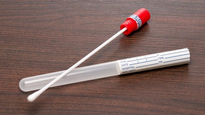 В Марий Эл зарегистрировано три новых случая заражения COVID-19