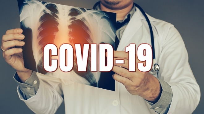 В Марий Эл за сутки выявлено 168 случаев заболевания коронавирусом