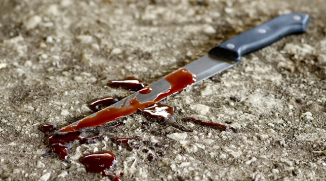 45-летний житель Параньгинского района порезал 33-летнюю дочь сожительницы