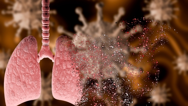 В Марий Эл новая жертва COVID-19