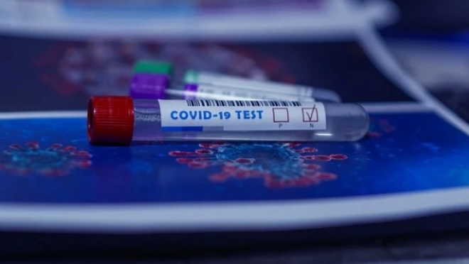 467 пациентов инфекционных стационаров Марий Эл нуждаются в кислородной поддержке