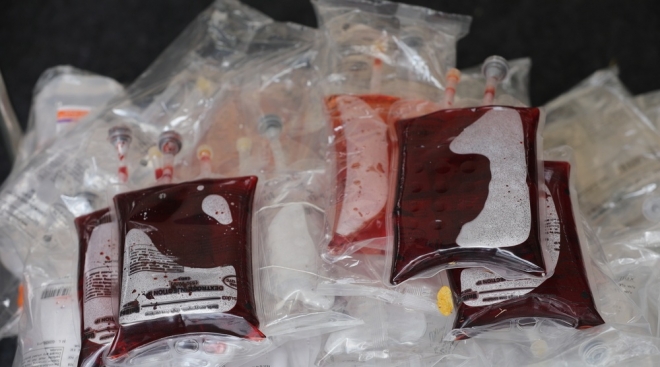 В Марий Эл нехватка крови А(II)