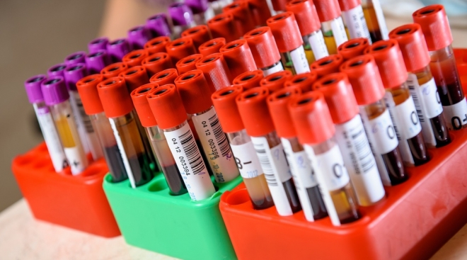 Главный внештатный эндокринолог Минздрава РМЭ рекомендует контролировать уровень сахара в крови