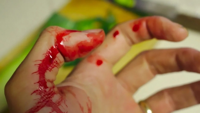 По подозрению в нанесении ножевого ранения в Йошкар-Оле задержана женщина