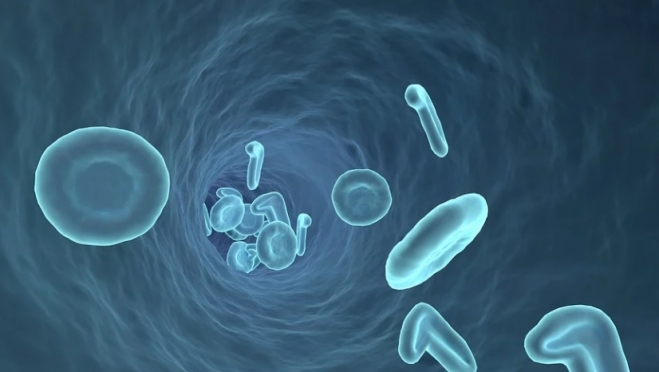 В Йошкар-Олинской городской больнице идёт монтаж нового ангиографа