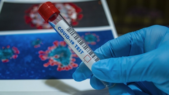 Почти четверть пациентов инфекционных стационаров Марий Эл – с коронавирусом