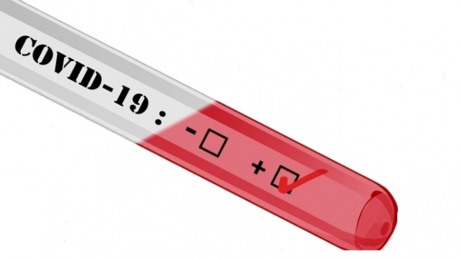 Где в Марий Эл можно провериться на коронавирус