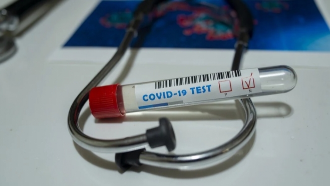В инфекционных стационарах республики лечатся 82 человека с COVID-19