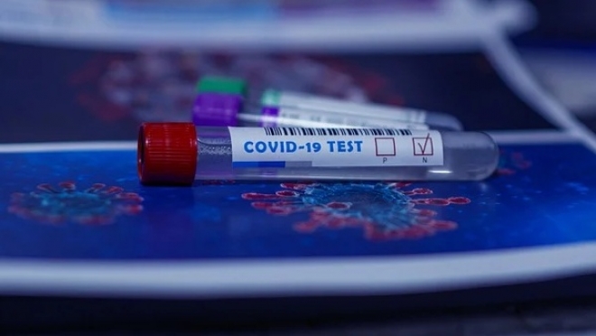 В Марий Эл почти половина заболевших перенесли коронавирус в легкой форме