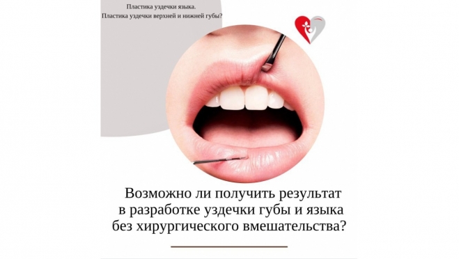 Возможно, ли получить результат в разработке уздечки губы и языка без хирургического вмешательства?