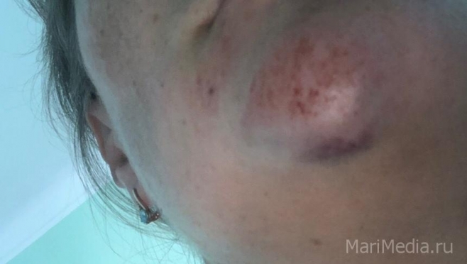 В Йошкар-Оле ищут велосипедистку, сбившую женщину