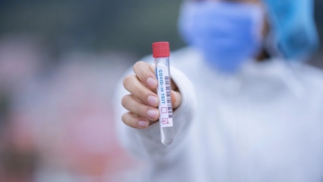 Количество пациентов с коронавирусом в больницах Марий Эл перевалило за 300