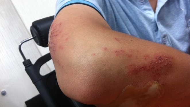 Сотрудники ЧОПа подозреваются в разбойном нападении на йошкаролинца