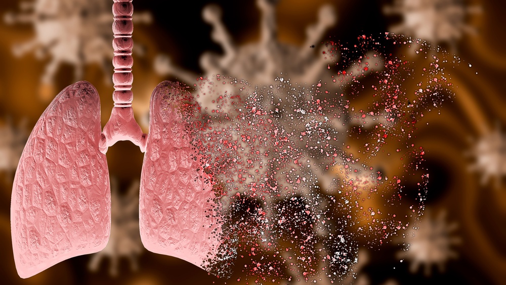 В Марий Эл число заражённых коронавирусом продолжает расти