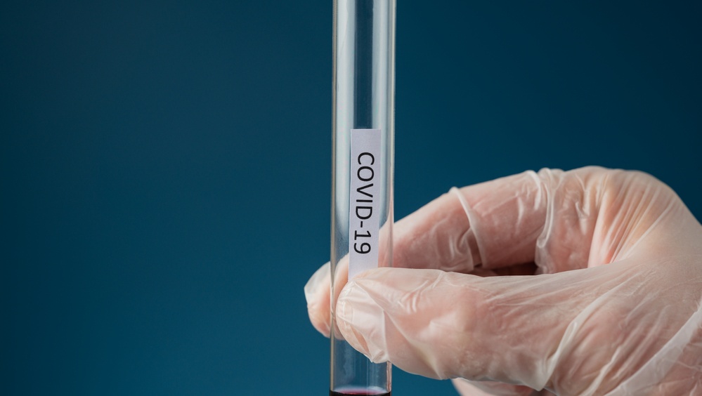 В Марий Эл за неделю COVID-19 заболели полсотни человек