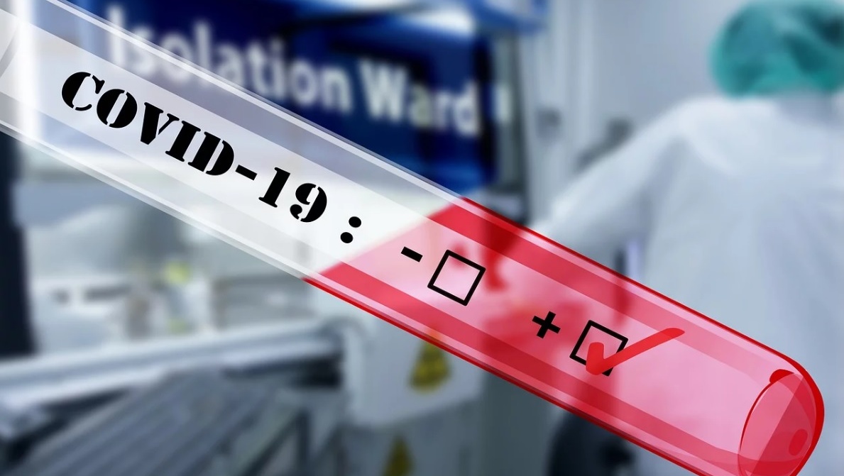 В Марий Эл ежедневно фиксируется полсотни заболевших COVID-19