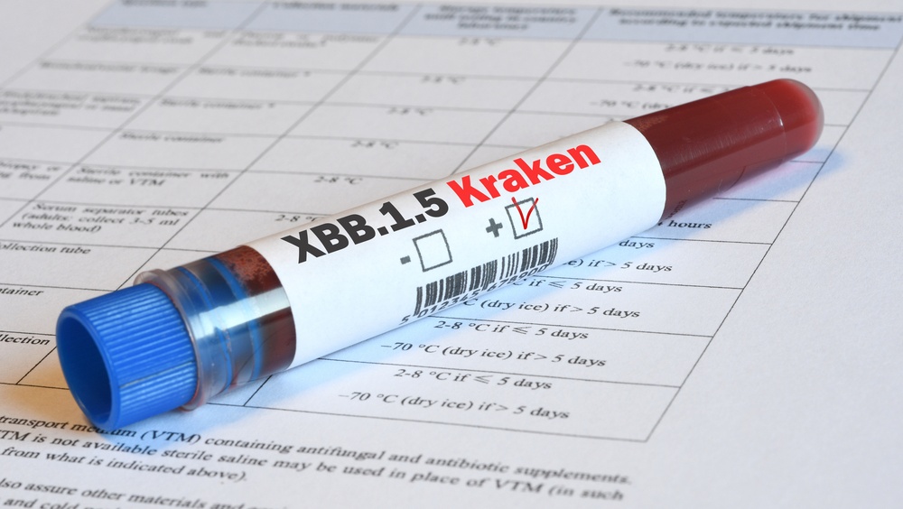 В Марий Эл более 140 человек заболели COVID-19 за неделю