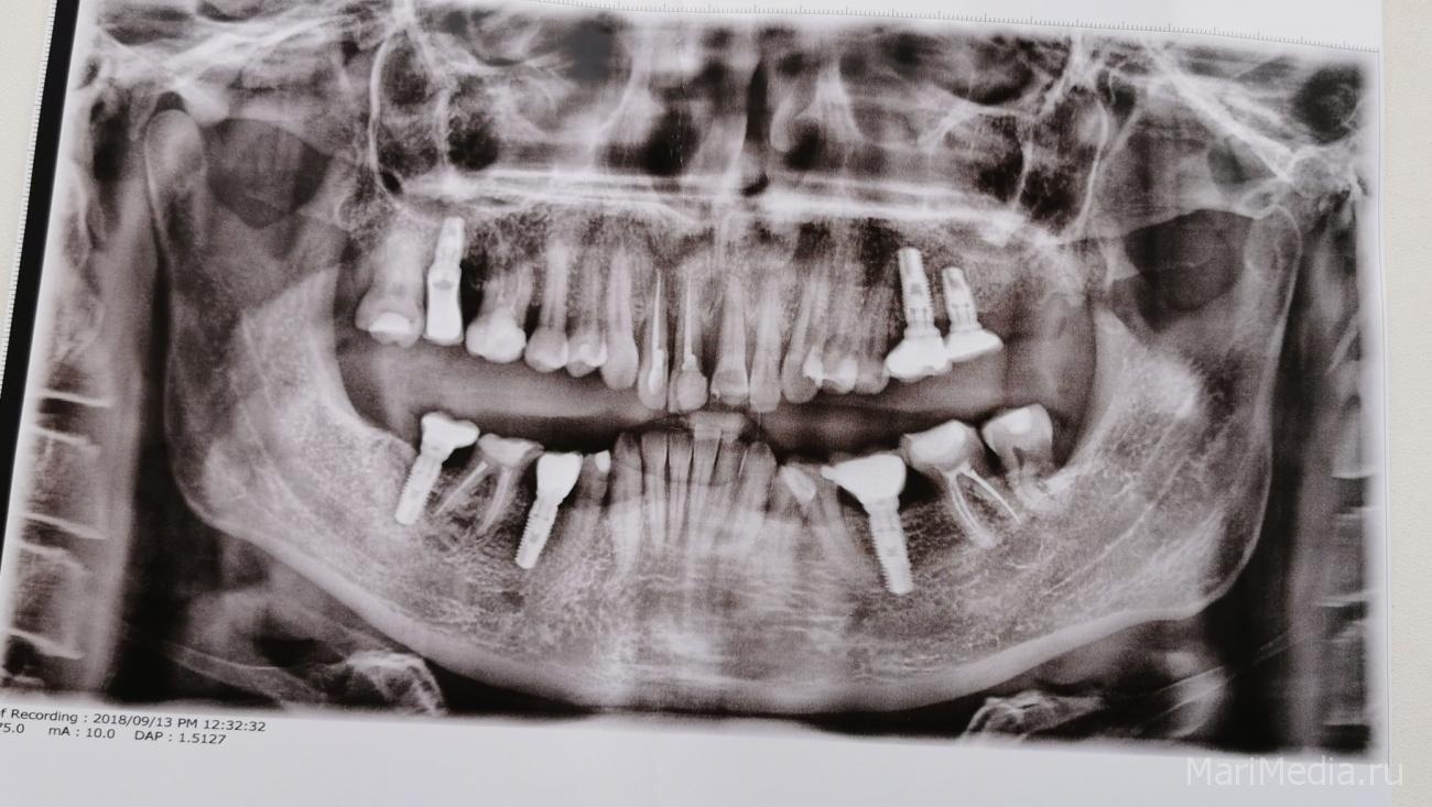 Стоматологии Марий Эл ждут отмены приказа Минздрава России