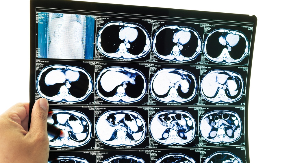 За 5 лет в Марий Эл на медоборудование потратят 858 млн рублей