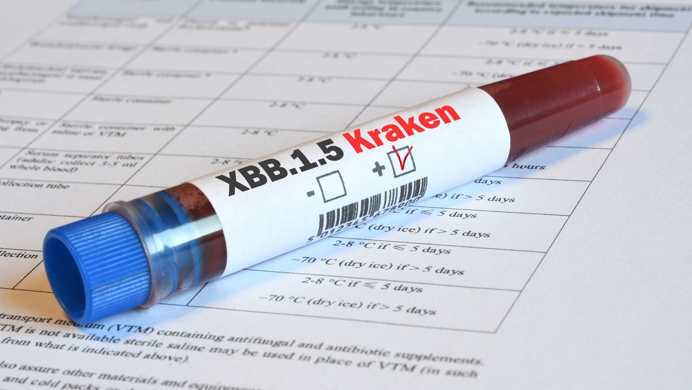 В Марий Эл показатель заболеваемости коронавирусом за неделю сократился на 52,2%