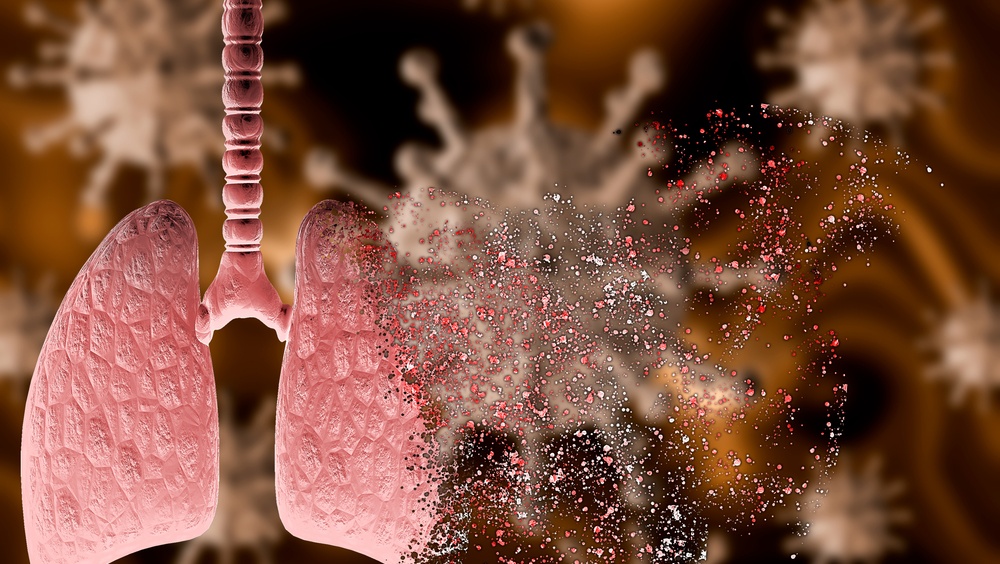 В Марий Эл новая жертва COVID-19