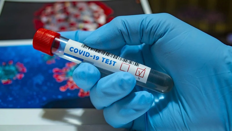 В Марий Эл провели почти 30 тысяч исследований на COVID-19