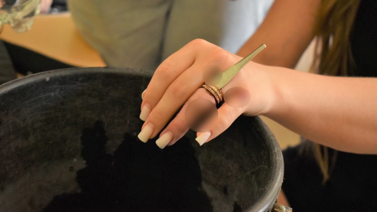 Марийские спасатели распилили кольца девушки и мужчины