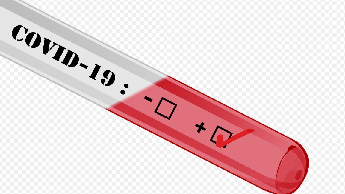 В Башкирии подтвердились первые случаи заражения коронавирусом